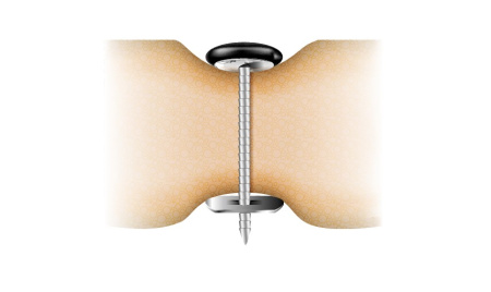 Пуговица 28"'  с гвоздем 25 мм (1 тыс)